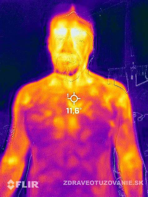 Termokamera: rozdiel teploty steny pred a po aplikácii Q-THERM®