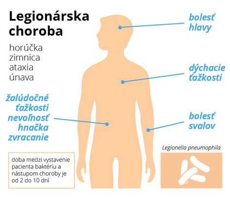 Infografika: Porovnanie príznakov legionárskej choroby a bežnej chrípky